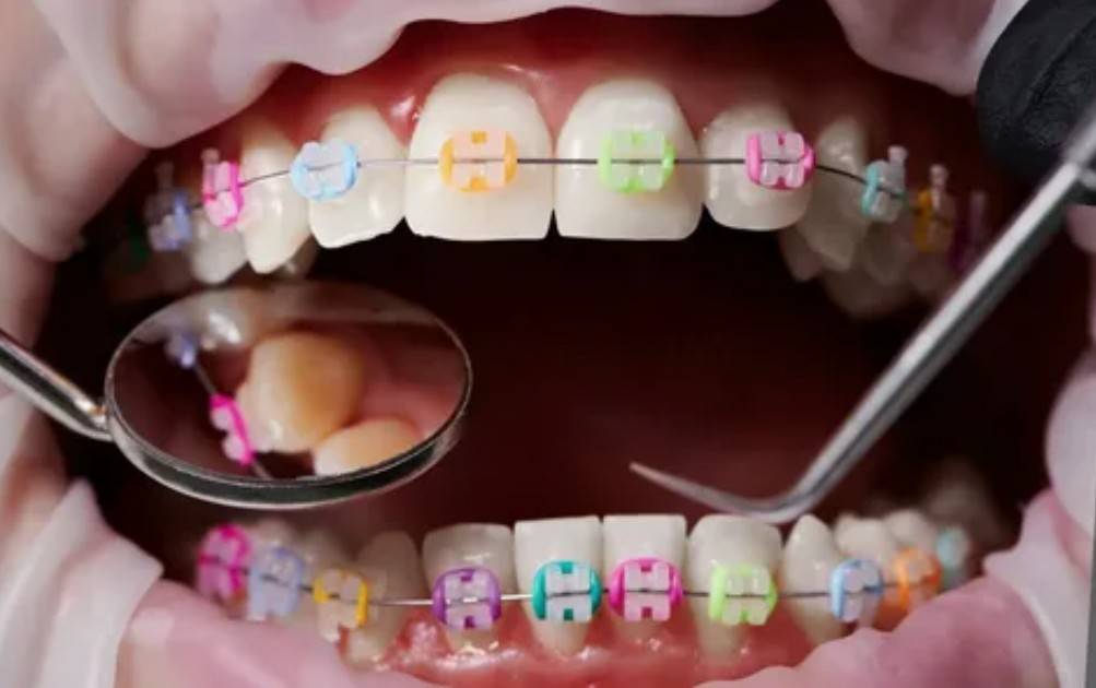 ortodontia e cirurgia ortognática